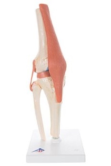 FUNCTIONAL KNEE JOINT 